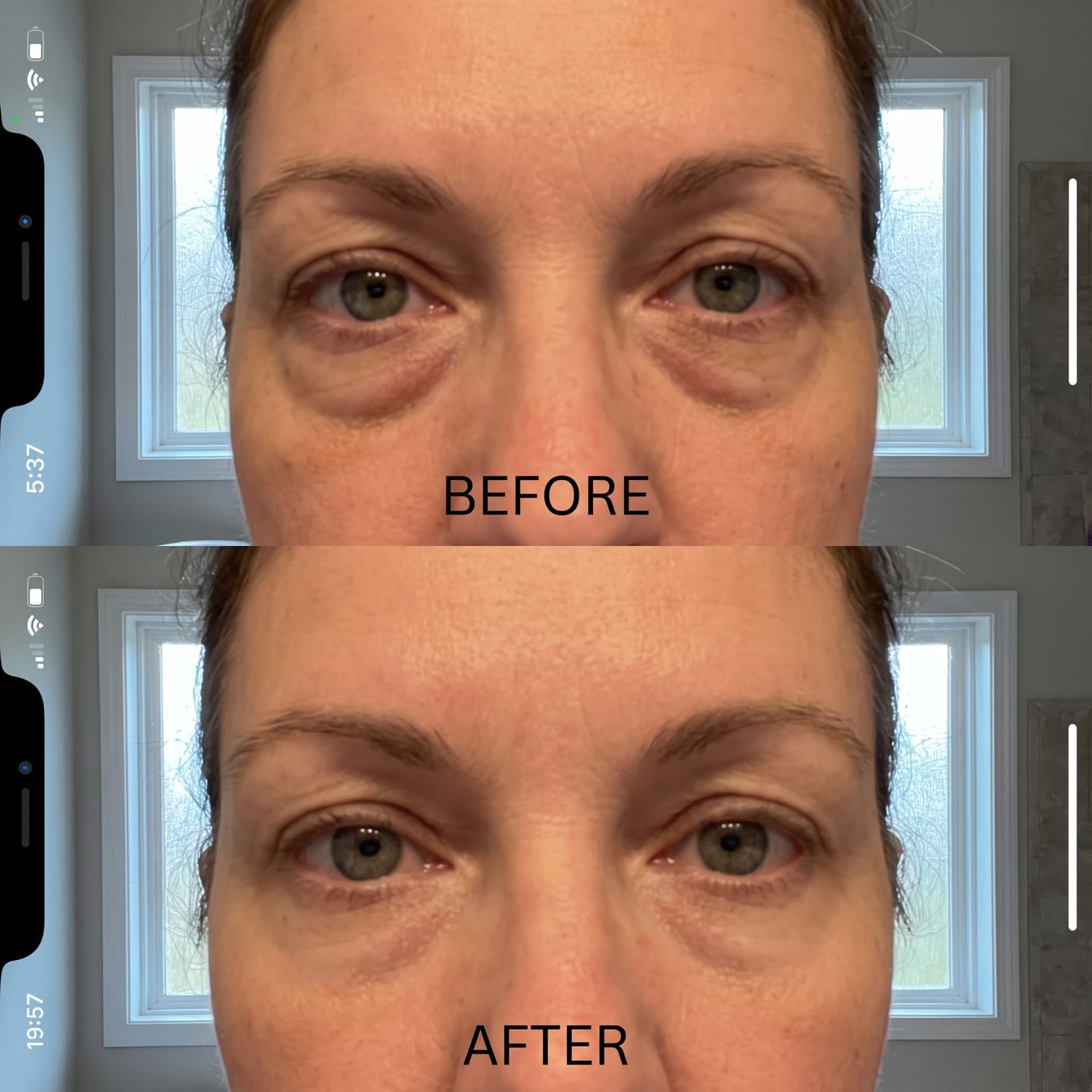 Customer photo review of Concele™ Instant Eye Firmer