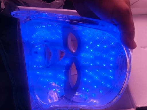 Customer photo review of Máscara facial LED