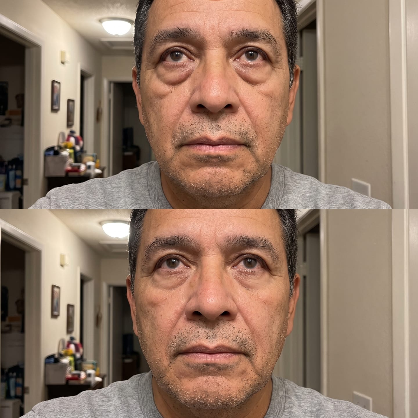 Customer photo review of Concele™ Instant Eye Firmer