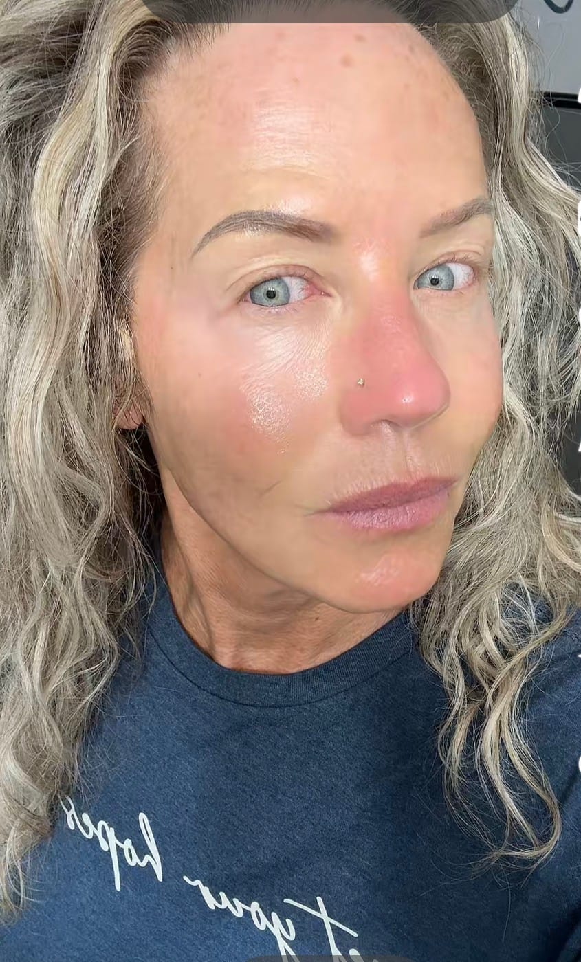 Customer photo review of 1 Month Supply - Collagen Mask