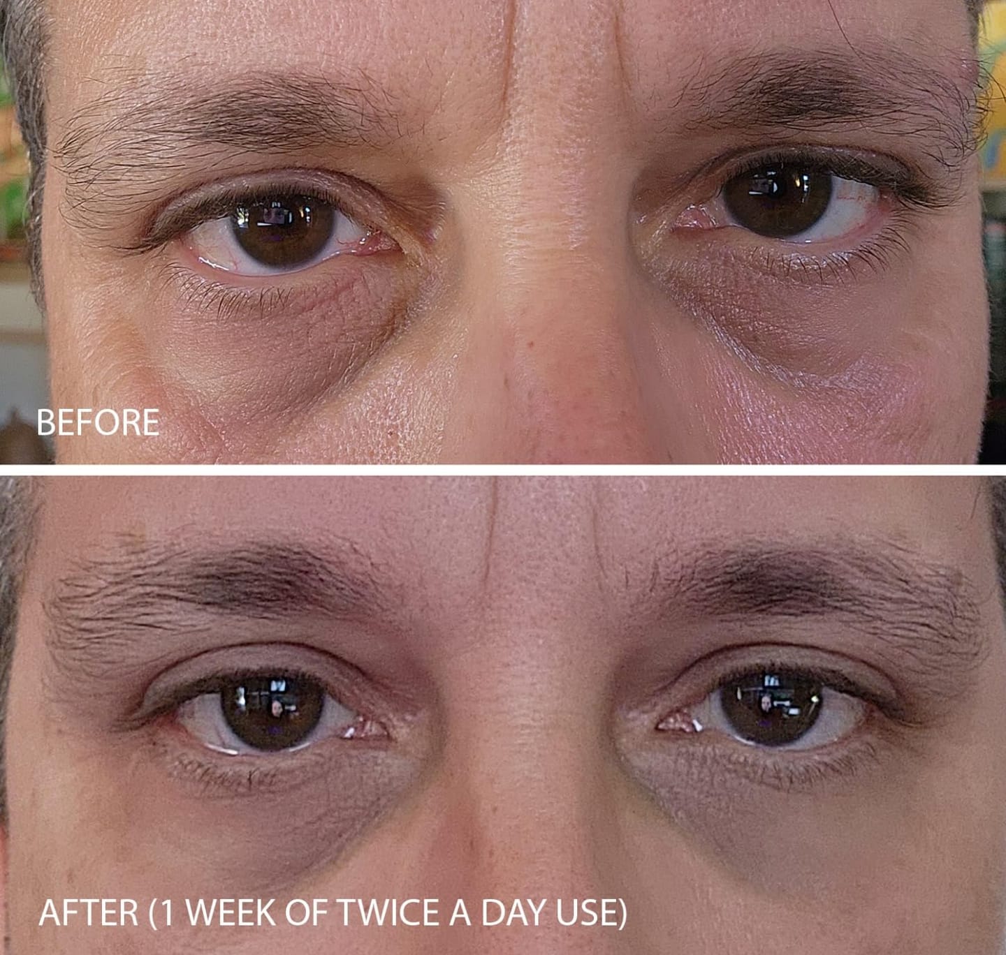 Customer photo review of Concele™ Instant Eye Firmer