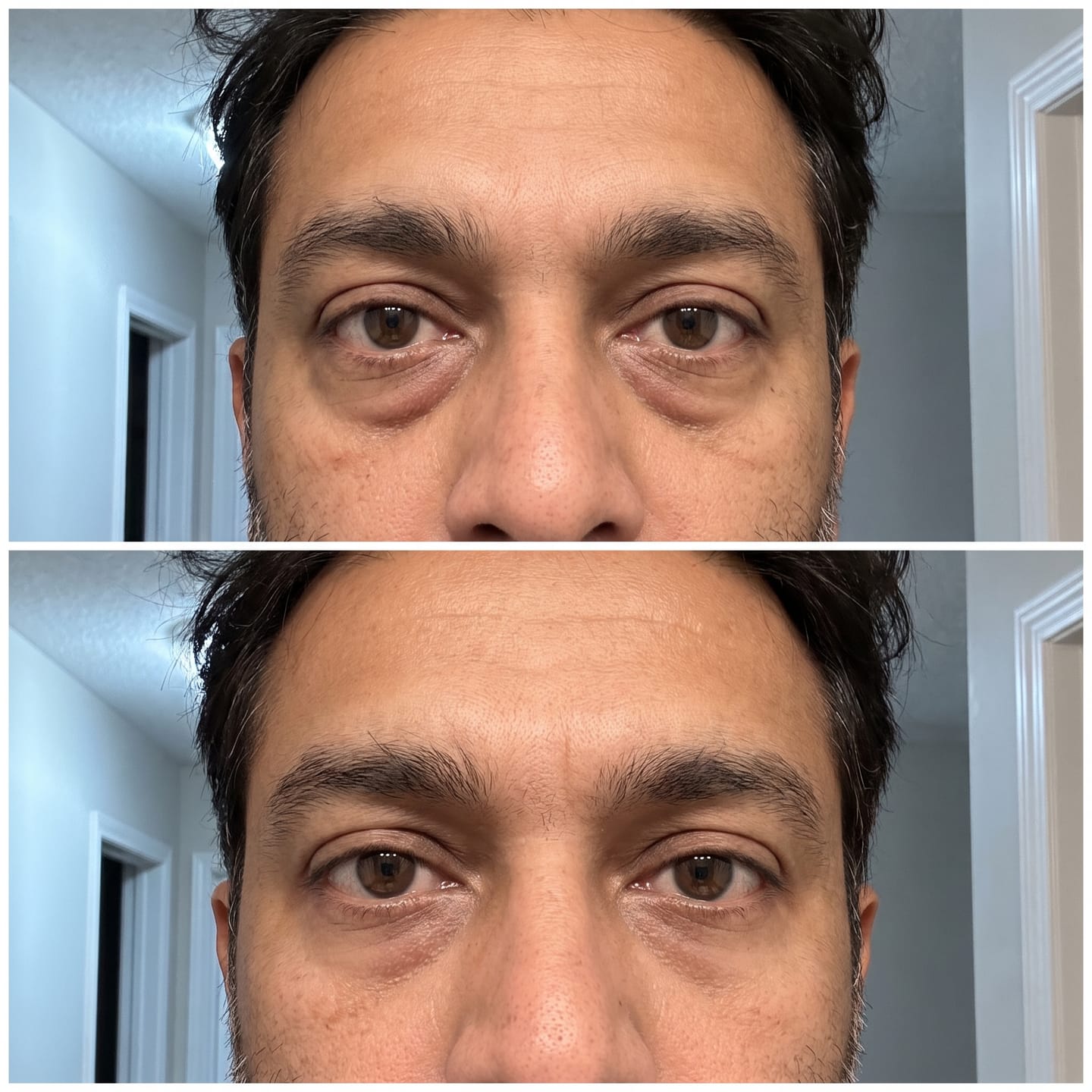 Customer photo review of Concele™ Instant Eye Firmer