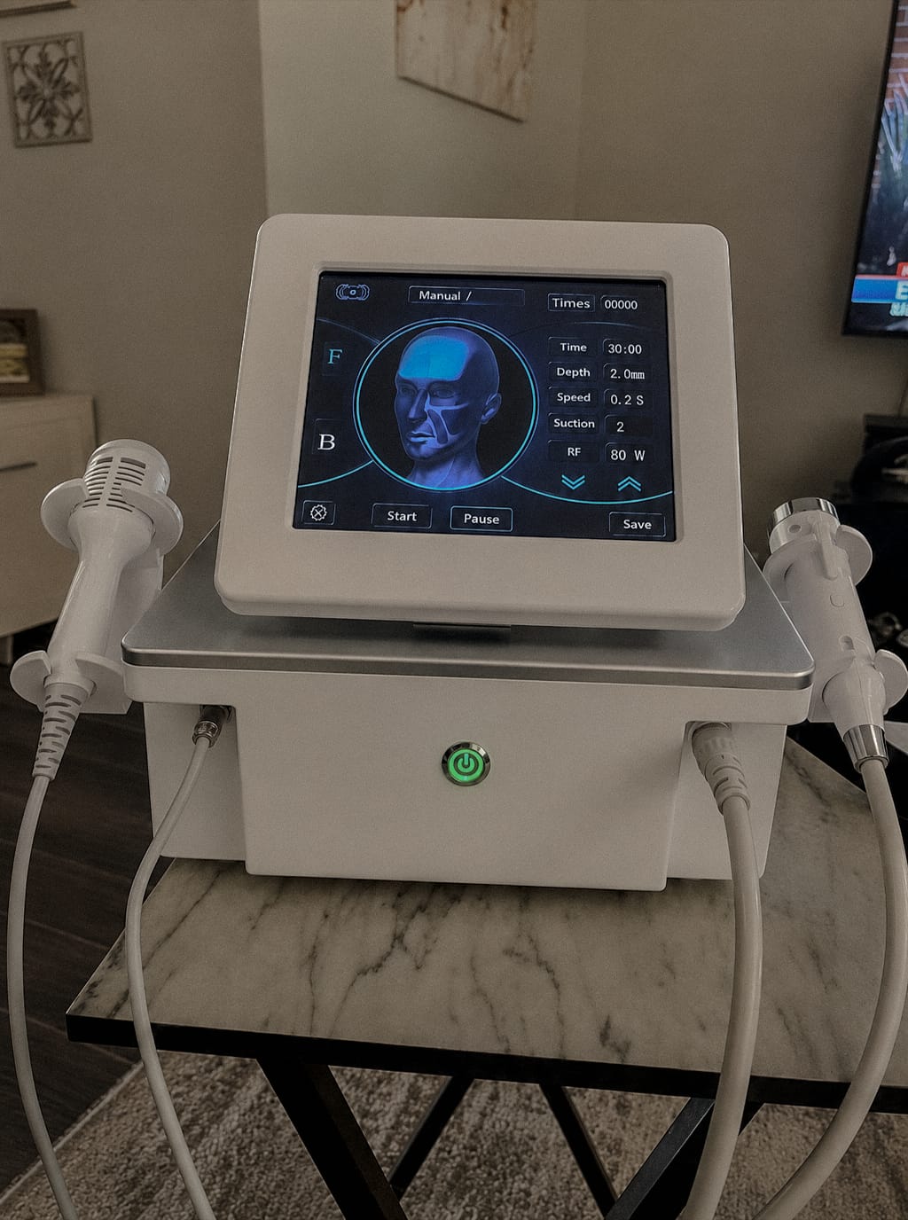 Customer photo review of RF Microneedling Machine Golden