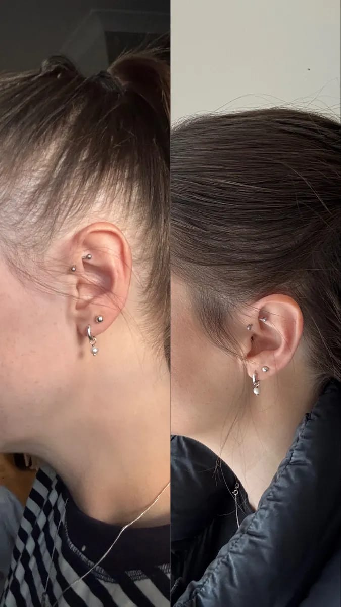 Customer photo review of Barra Coreana Revitalizante