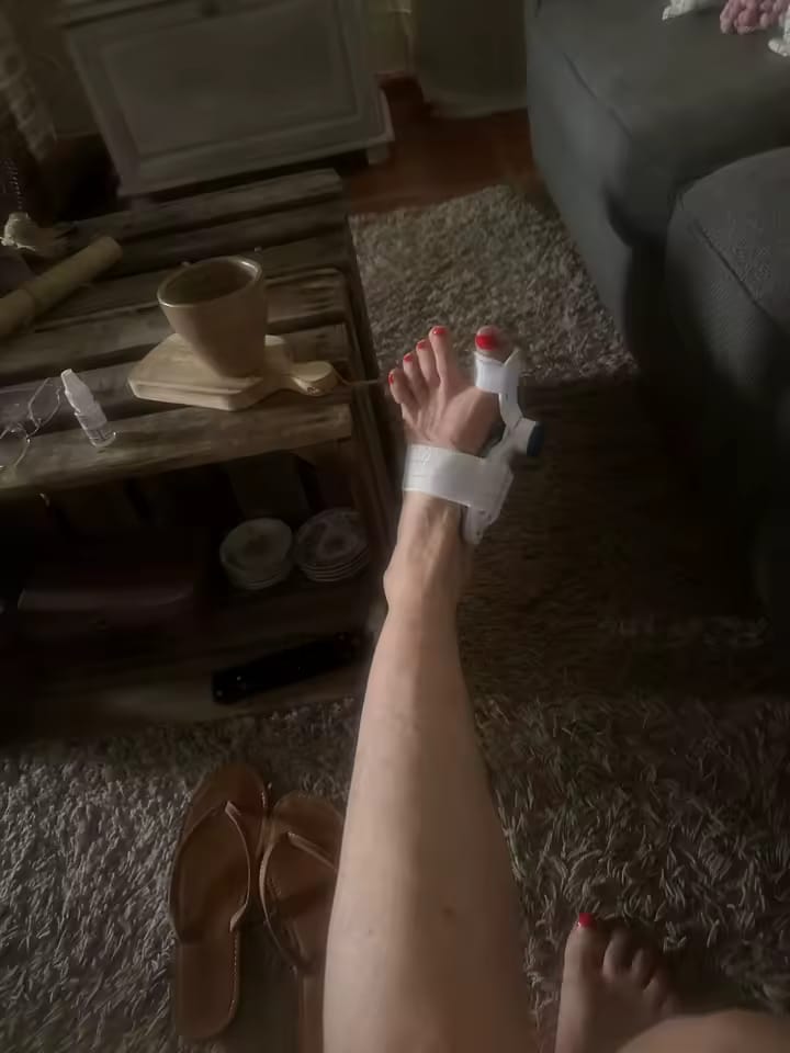Customer photo review of HalluxAlign™