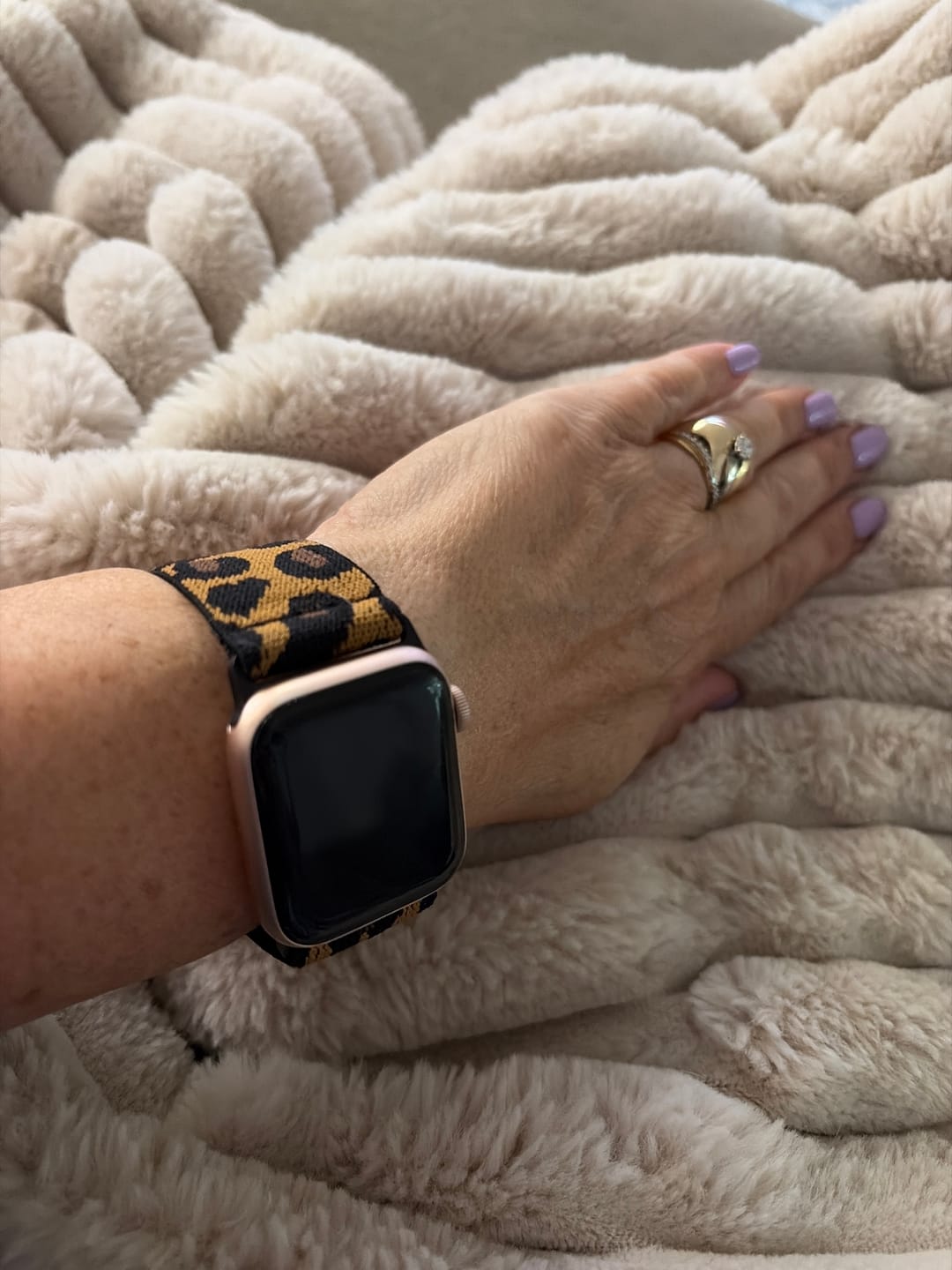 Customer photo review of Roxane Nylon Loop Band