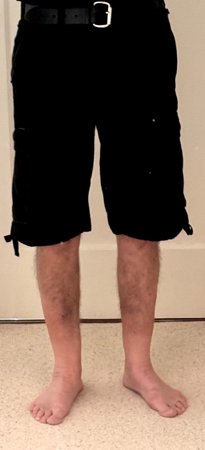 Customer photo review of Mil-Tec Brand Army style prewashed black moleskin lightweight paratrooper shorts