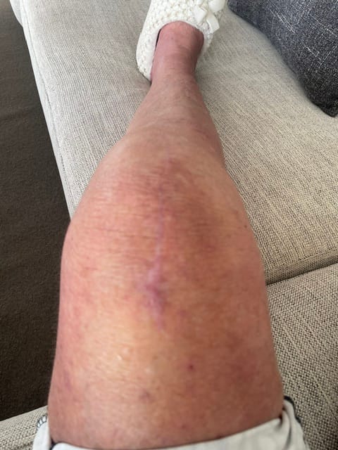 Customer photo review of Kawakawa Balm