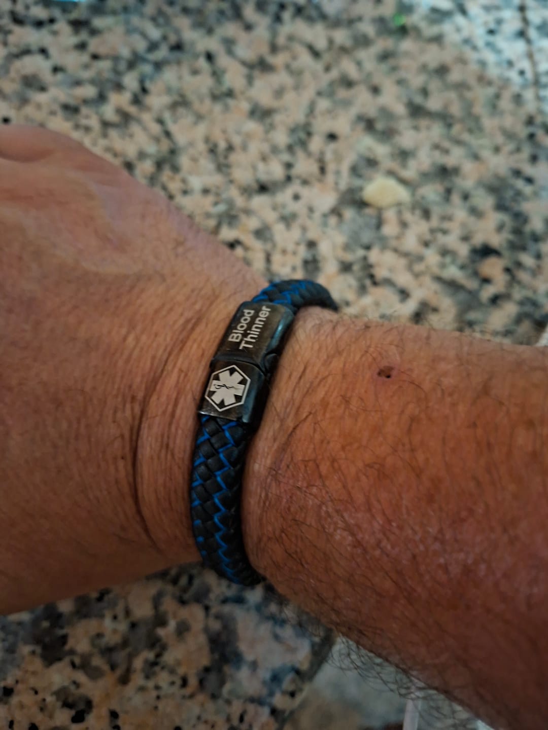 Customer photo review of Medizinisches Notfallarmband