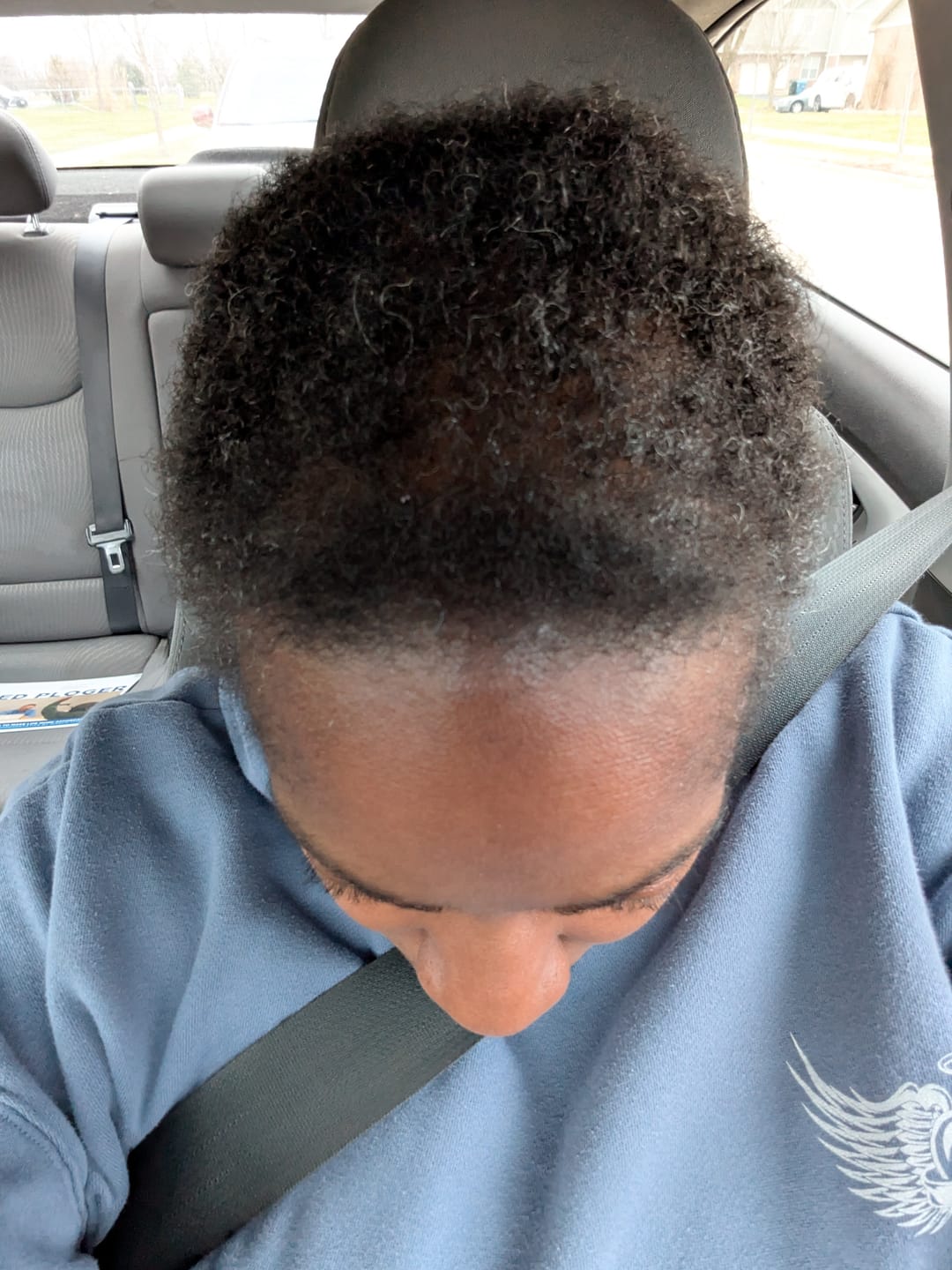 Customer photo review of Moisturize & Seal Bundle