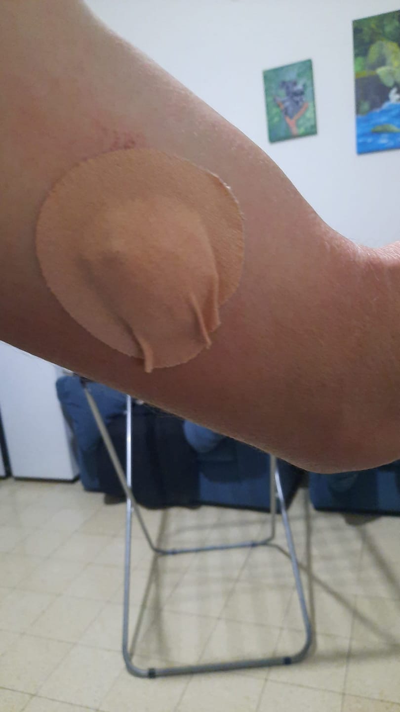 Customer photo review of Original Patch גוף 20 יח׳