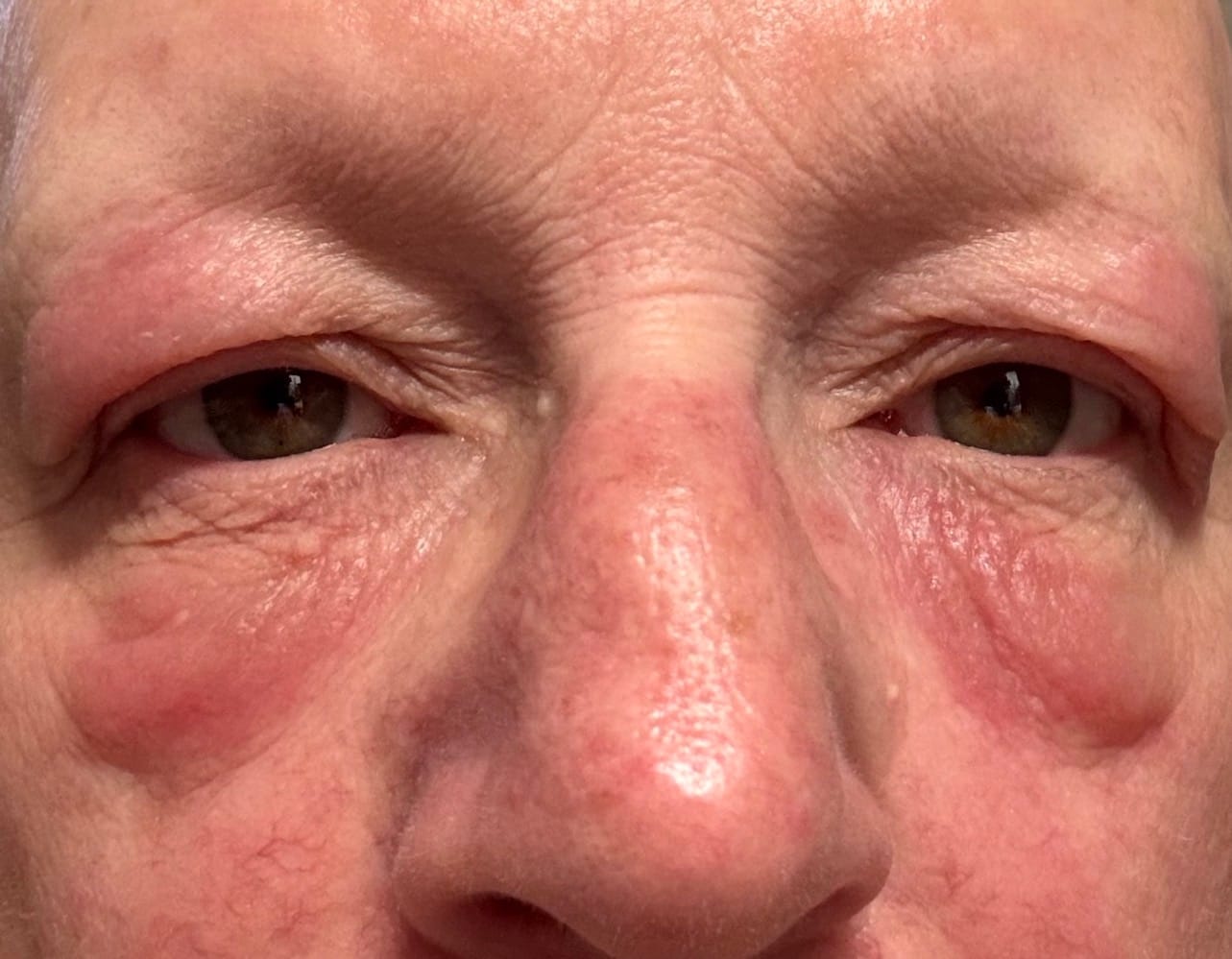 Customer photo review of Calm Balm