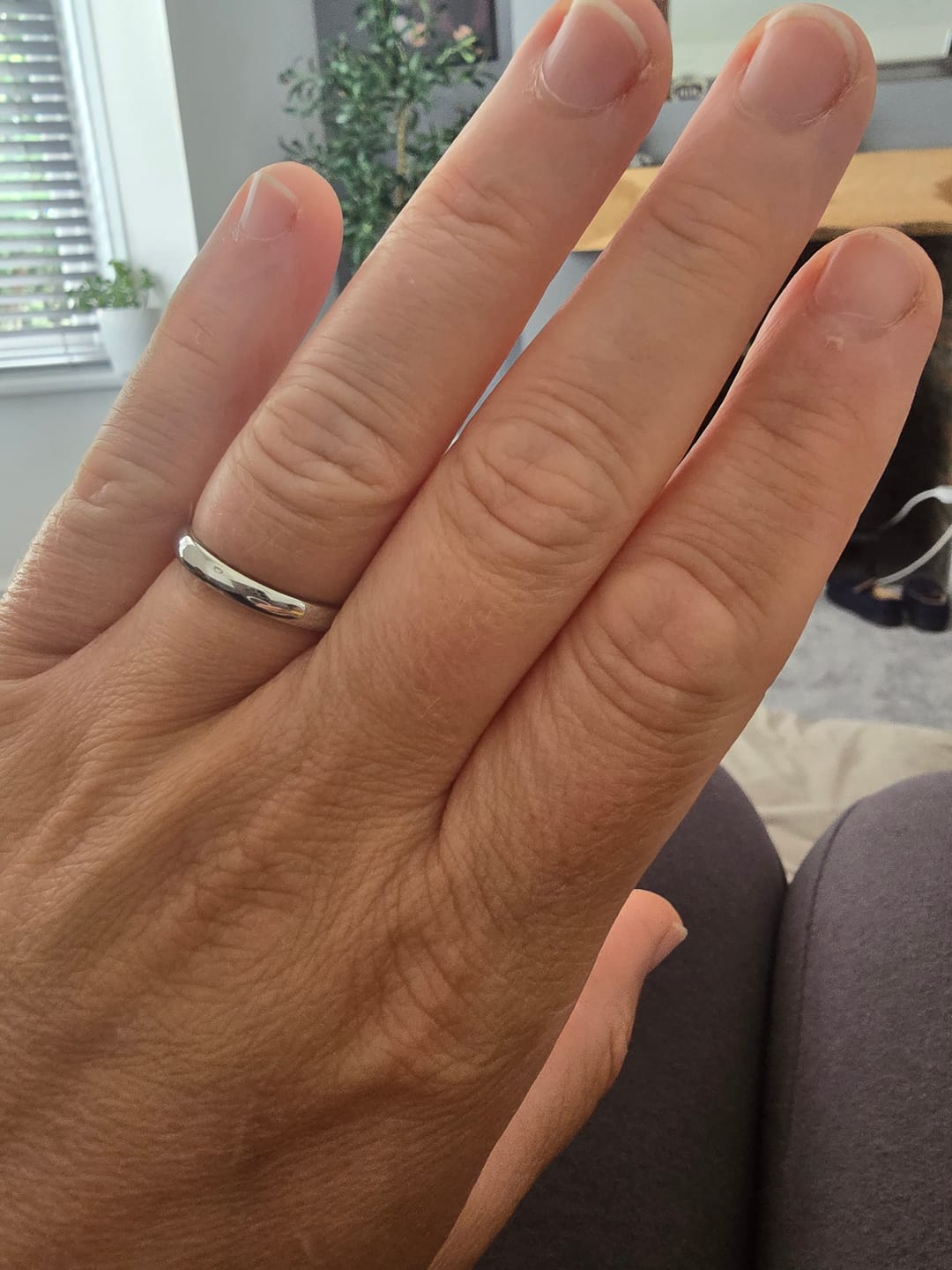 Customer photo review of White Gold 3mm Wonder Ring