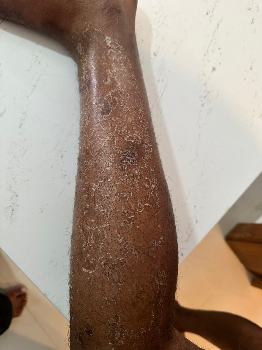 Customer photo review of Zena 100% Organic Algae Peel