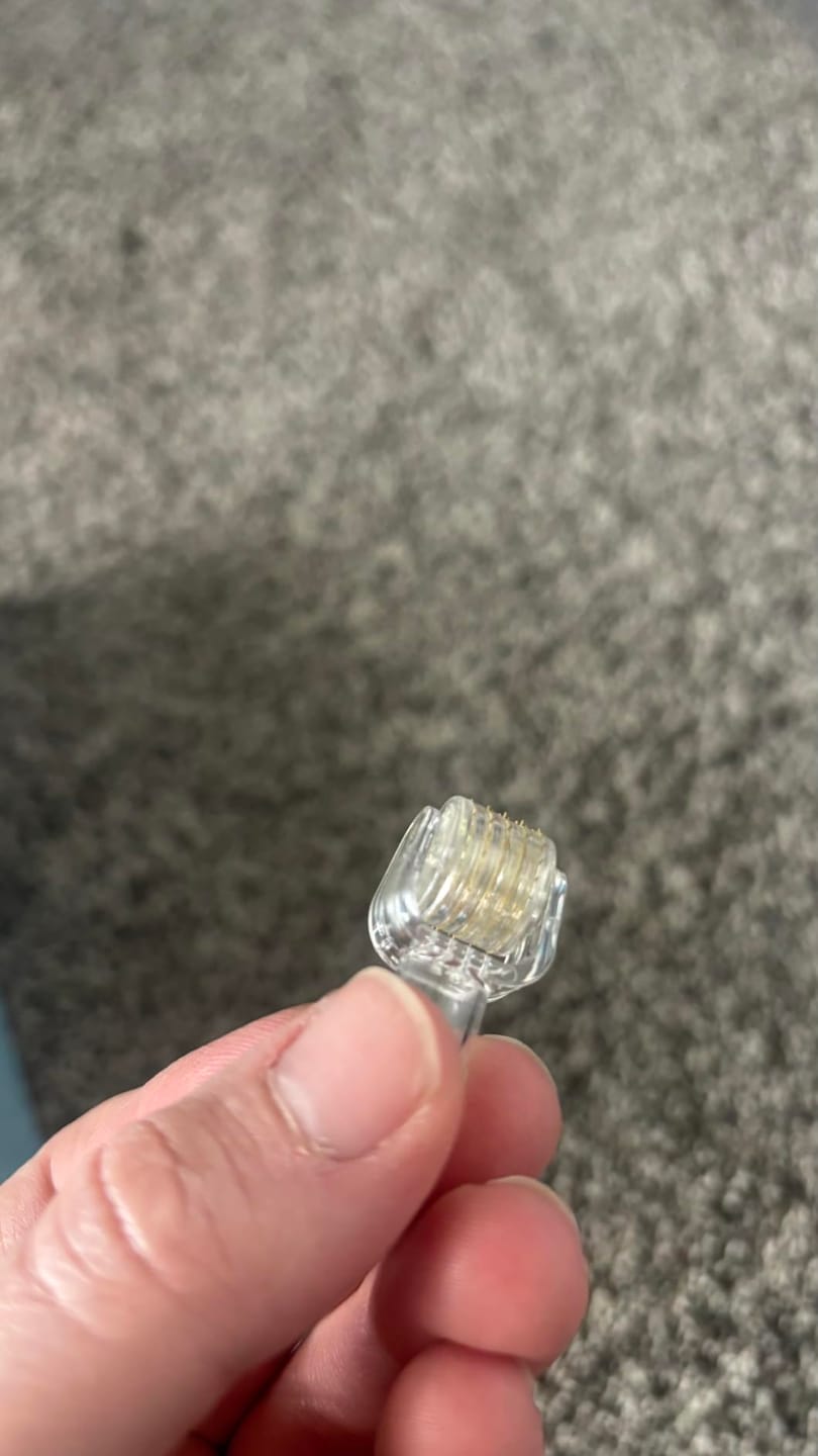 Customer photo review of Salutly • Rullo Microneedle Effetto Filler
