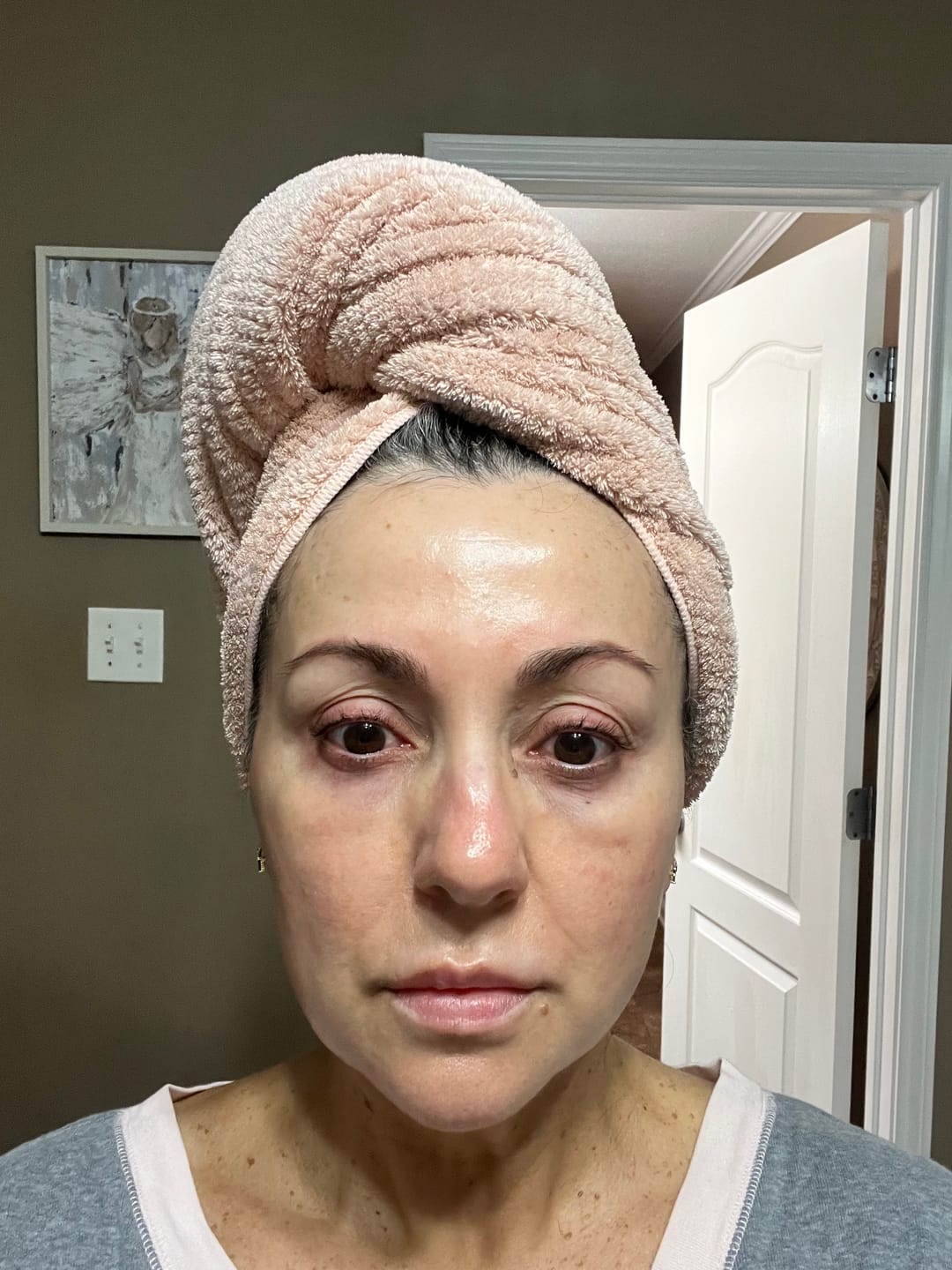 Customer photo review of ACTIVE PRO SERUM | ANTI-AGING