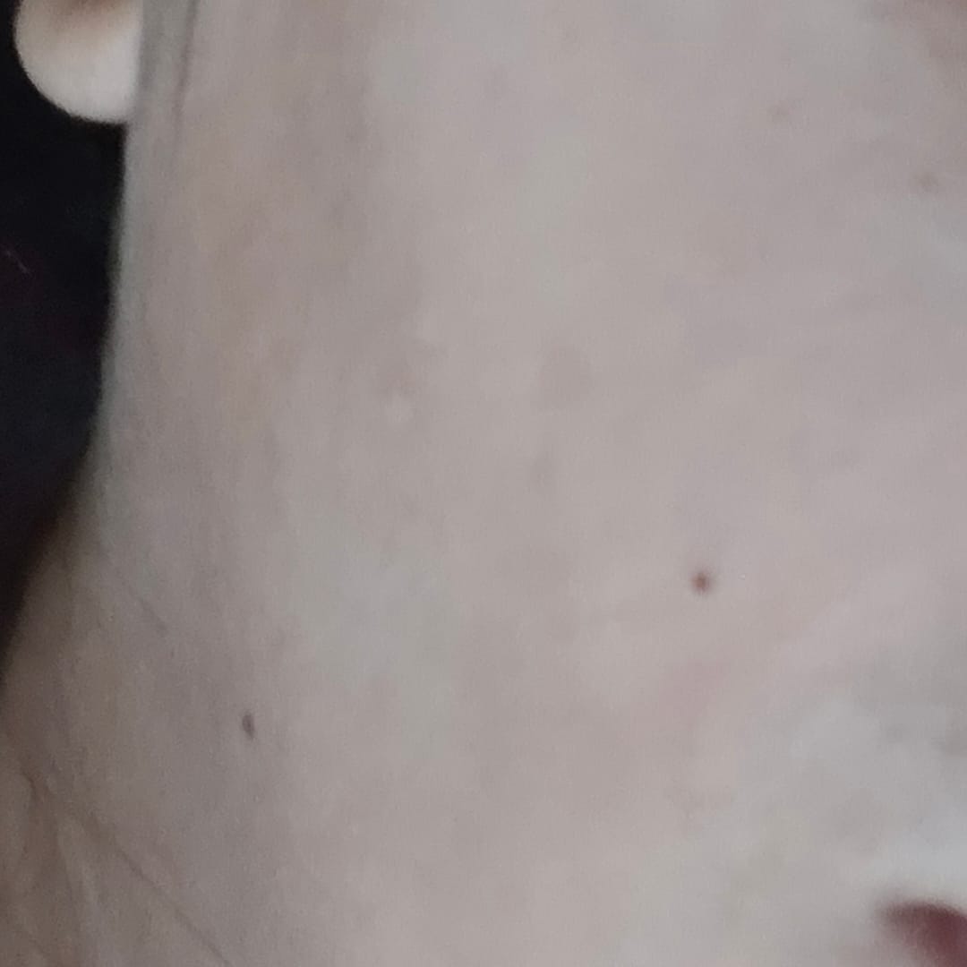Customer photo review of Maxdif Facewash
