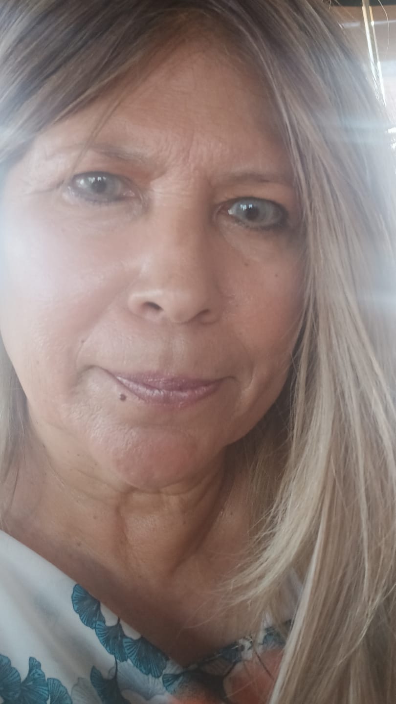 Customer photo review of Hidrocor Quartz Blue Gray Prescription Colored Contact Lenses