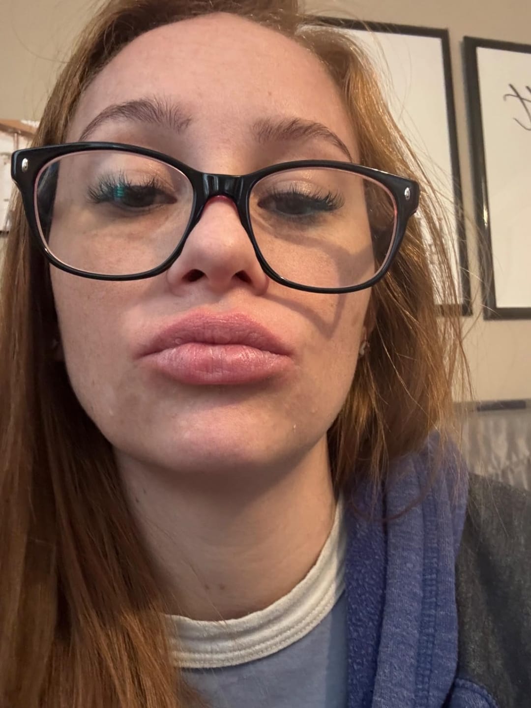 Customer photo review of Salutly • Rullo Microneedle Effetto Filler