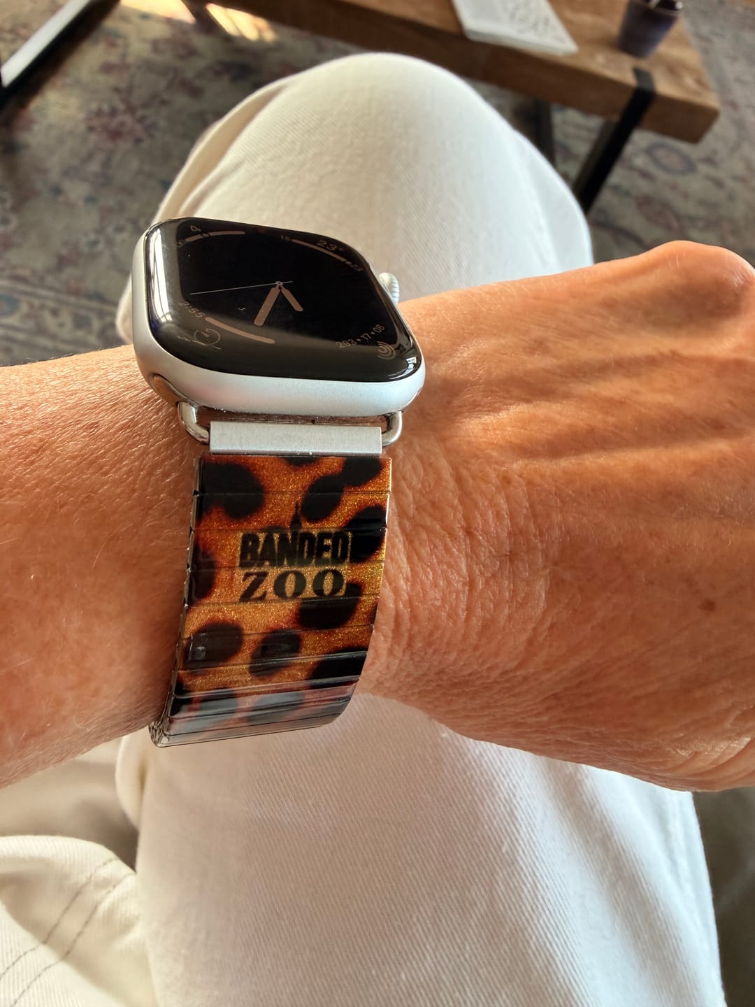 Customer photo review of Zoo - Leopard Metallic - Banded for Smart Watch