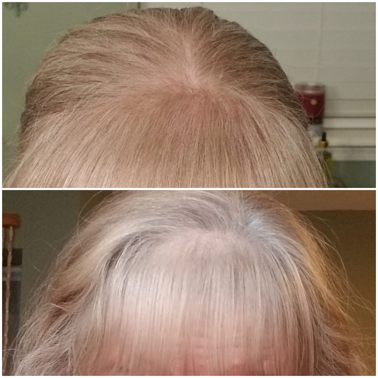 Customer photo review of INIA REGEN Laser & Red Light Cap