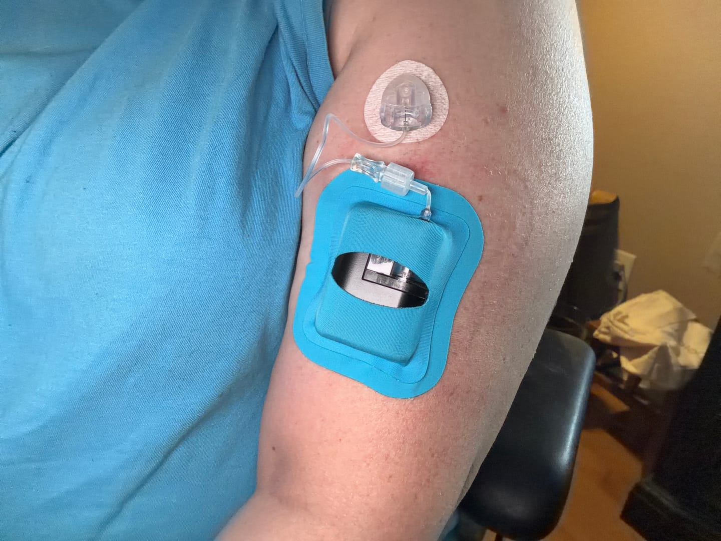 Customer photo review of Skin Grip - Tandem Mobi Pocket Patch