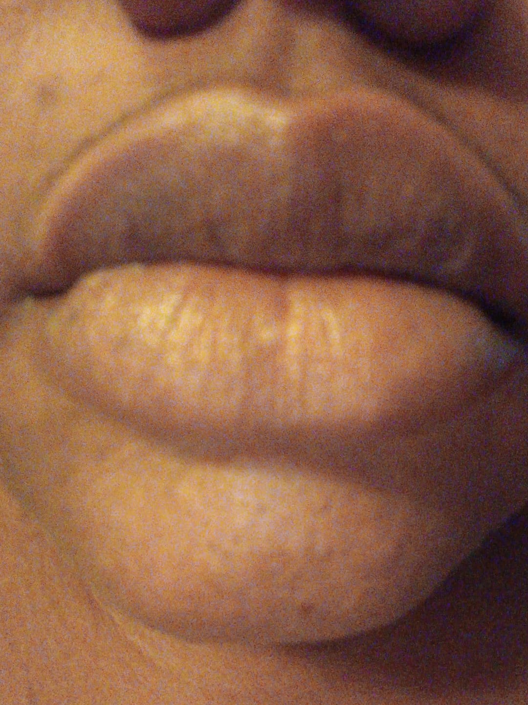 Customer photo review of Turmeric and Lemon Lip Balm (for Dark Lips)