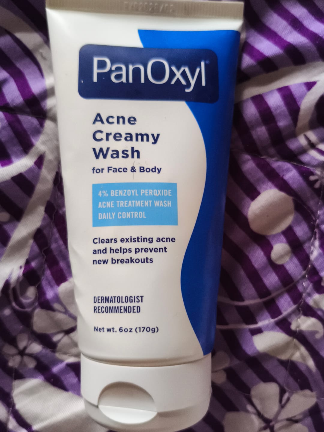 Customer photo review of Acne Creamy Wash 4% Benzoyl Peroxide