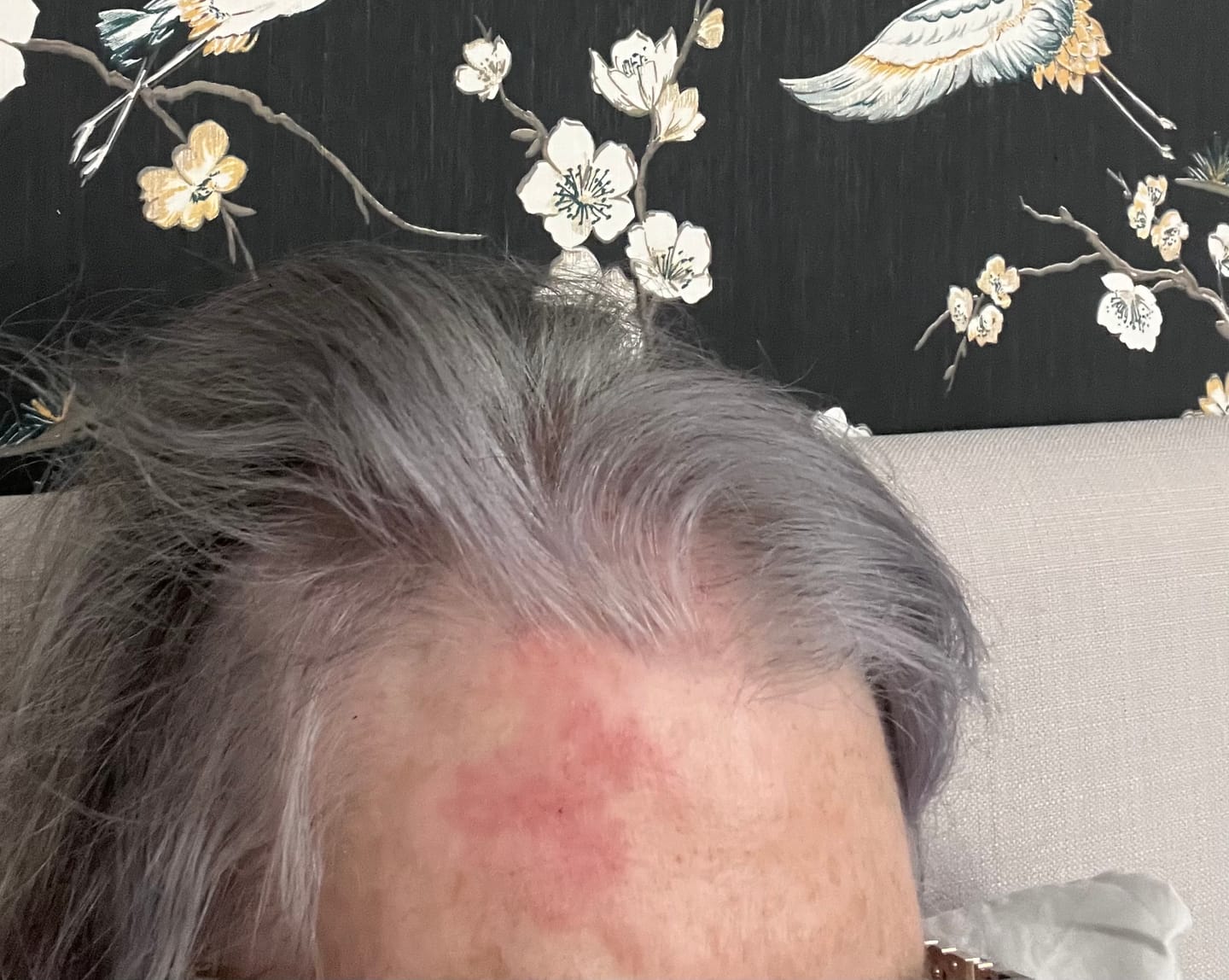 Customer photo review of Seb Natural Soothing Balm