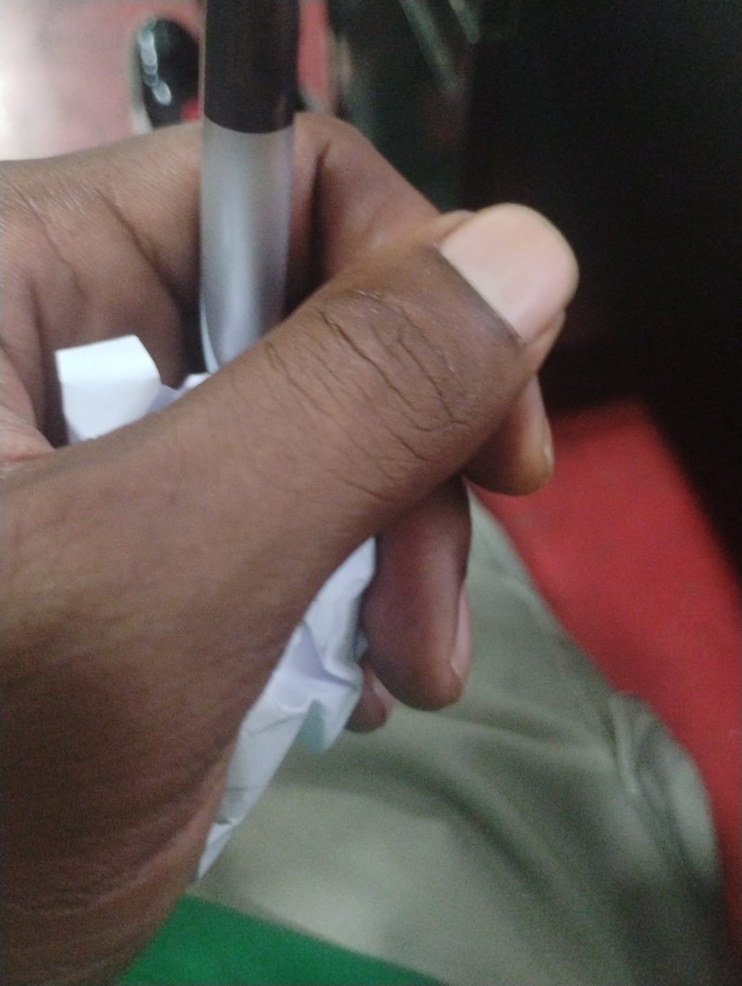 Customer photo review of Candy Gas Light Assist THCA
