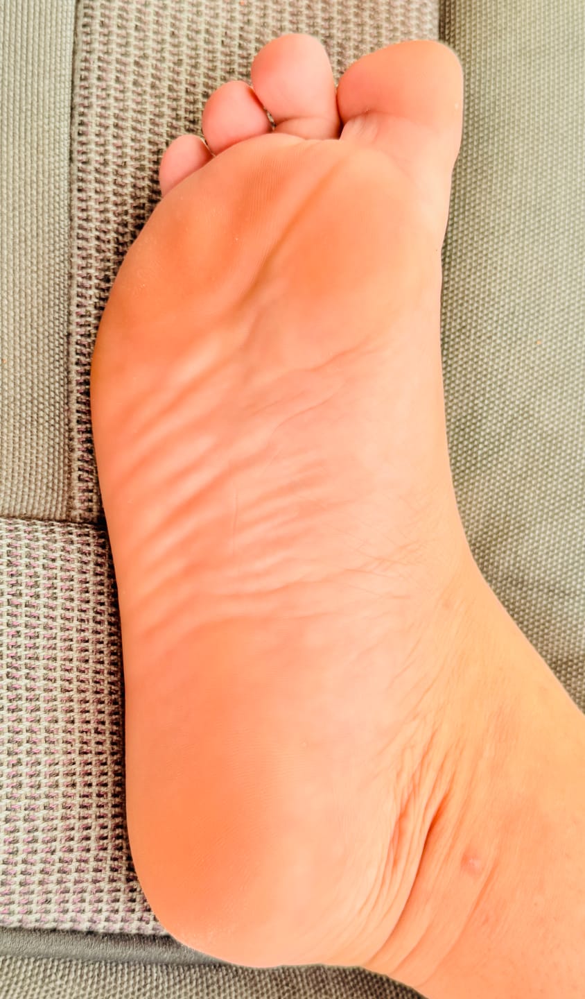 Customer photo review of Foot Balm