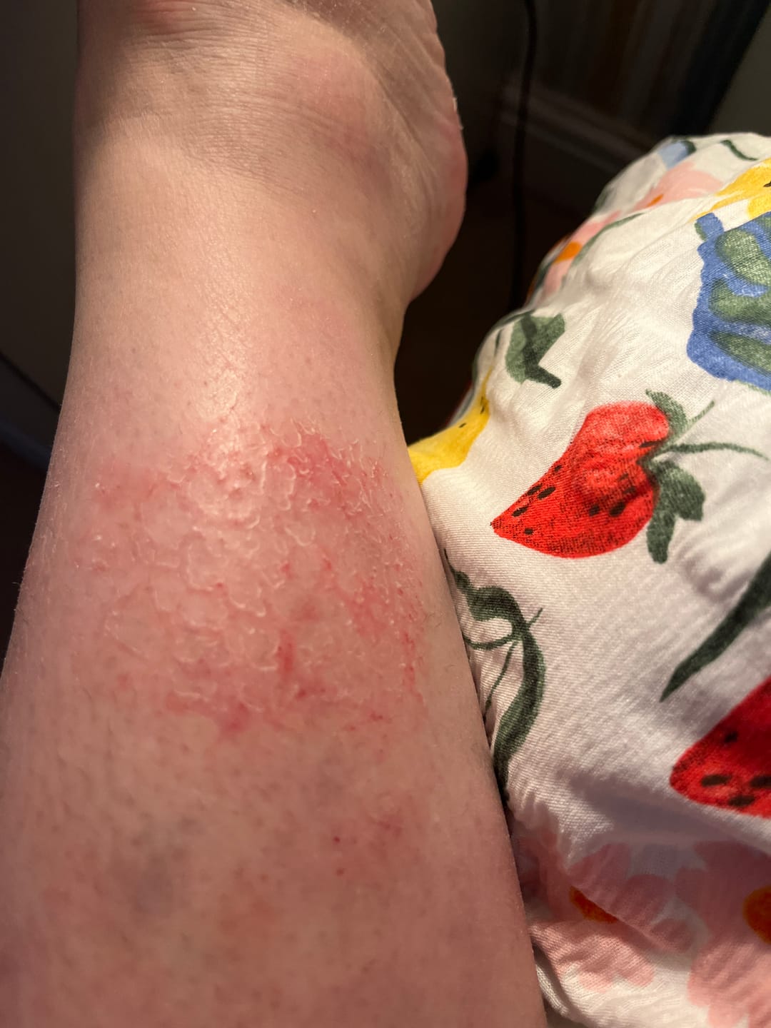 Customer photo review of Whipped Grass-Fed Tallow Body Cream | With Jojoba Oil