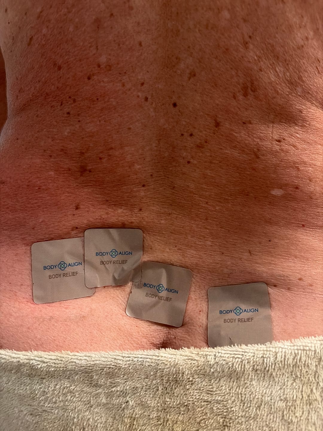 Customer photo review of Body Relief - Pain Patches