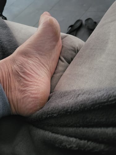 Customer photo review of Râpe Anti-Callosités Vantyx™ PRO