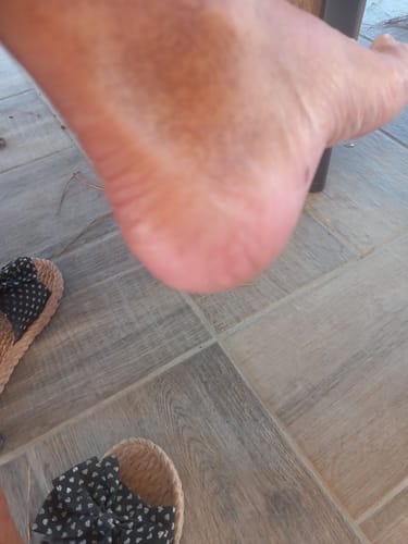 Customer photo review of Râpe Anti-Callosités Vantyx™ PRO