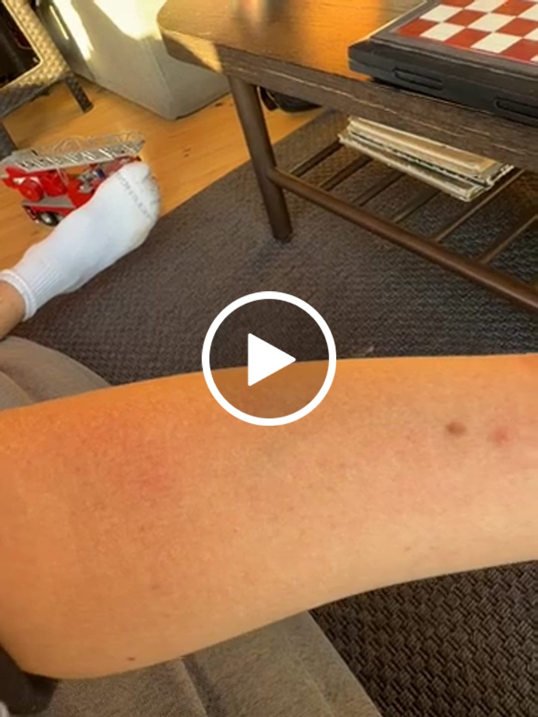 Customer video review of Depilador Nano Pro