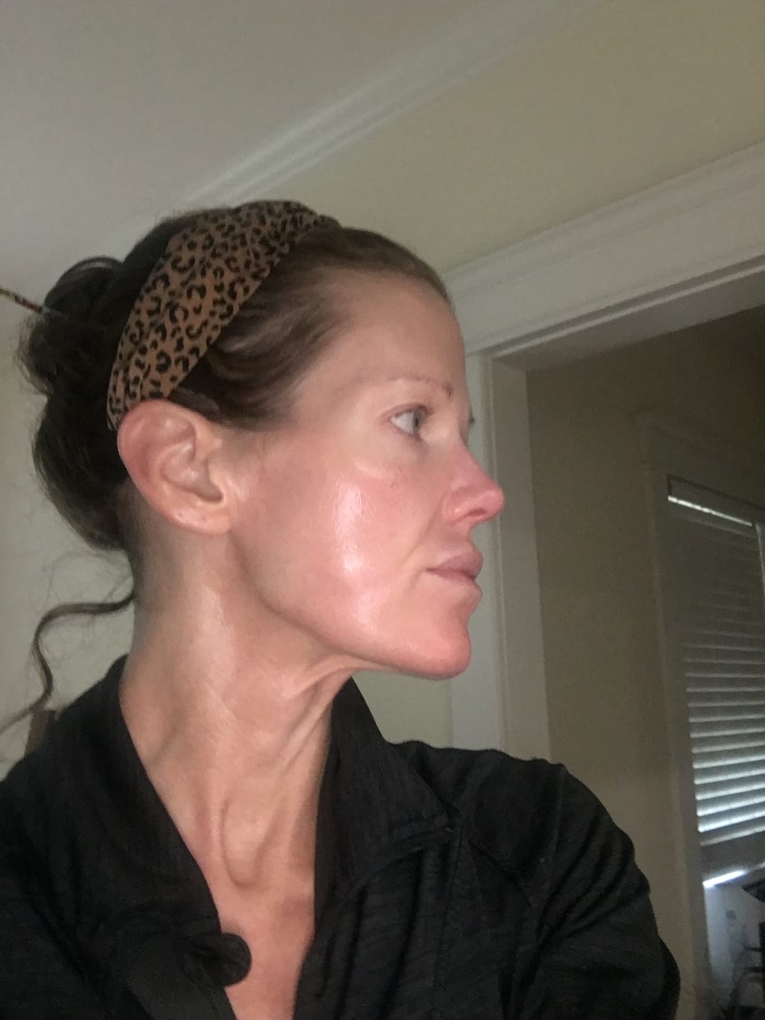 Customer photo review of ACTIVE PRO SERUM | ANTI-AGING