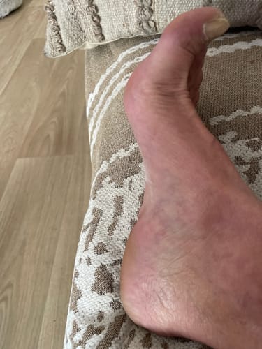 Customer photo review of Râpe Anti-Callosités Vantyx™ PRO