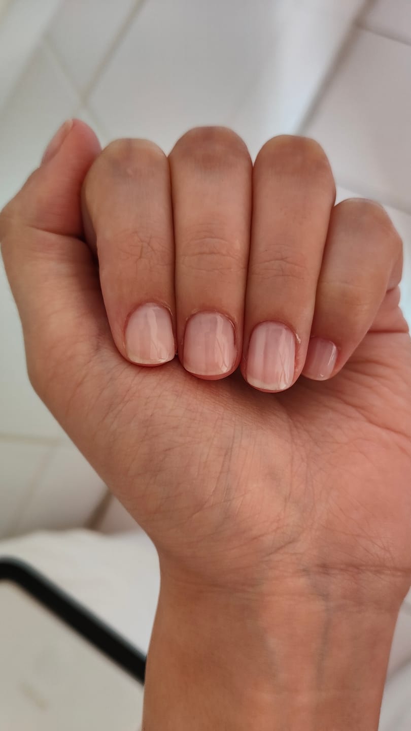 Customer photo review of Nail Prep - Sgrassatore LCI