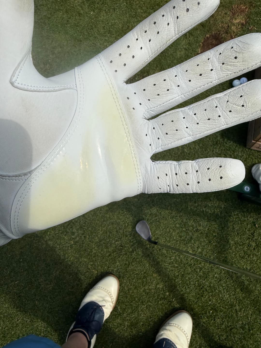 Customer photo review of Holen SureGrip Glove