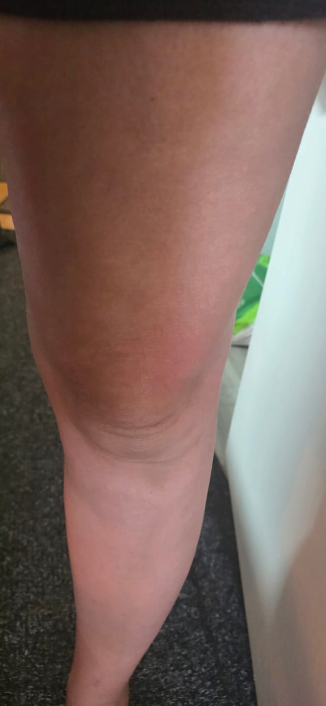 Customer photo review of Body For Us Anti-Cellulite Massage Oil