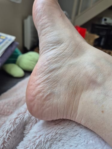 Customer photo review of Râpe Anti-Callosités Vantyx™ PRO