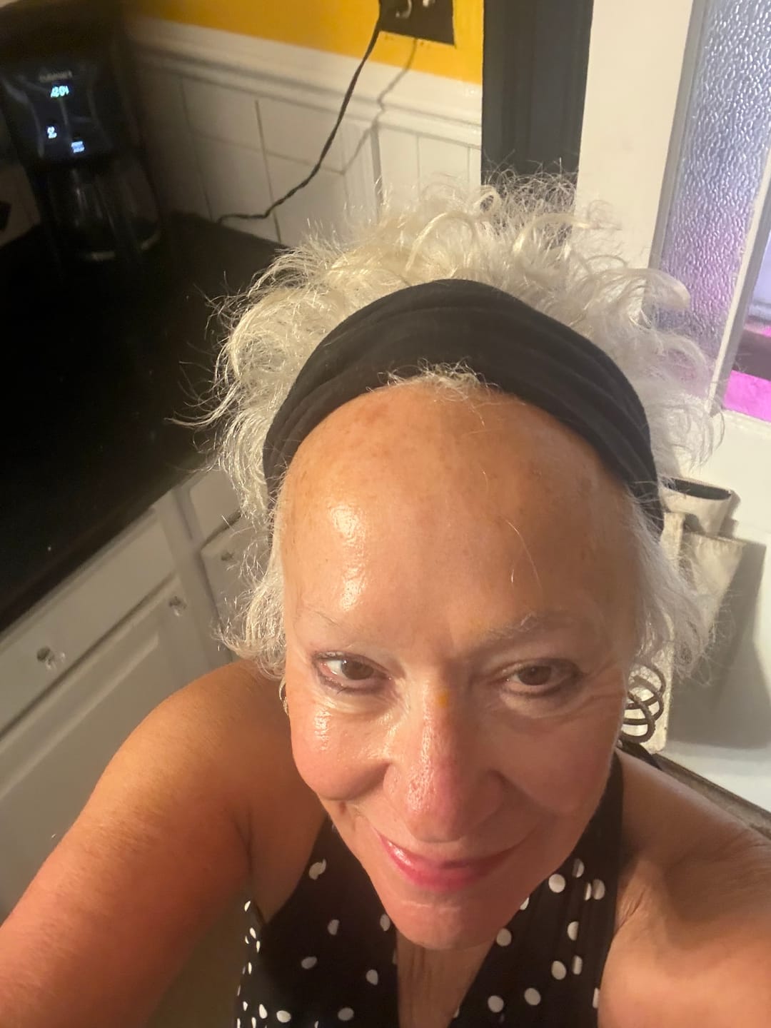 Customer photo review of Anti-Age & Insane Glow Day Balm