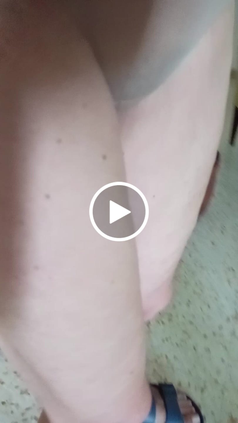 Customer video review of Crema ricompattante corpo