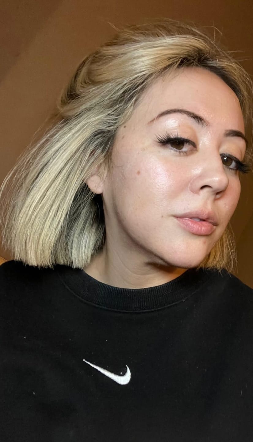 Customer photo review of Luelle Wrinkle Patches