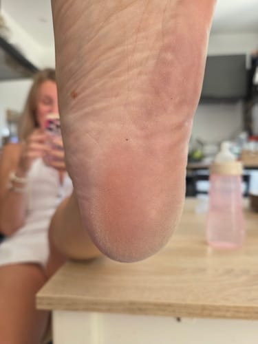 Customer photo review of Râpe Anti-Callosités Vantyx™ PRO