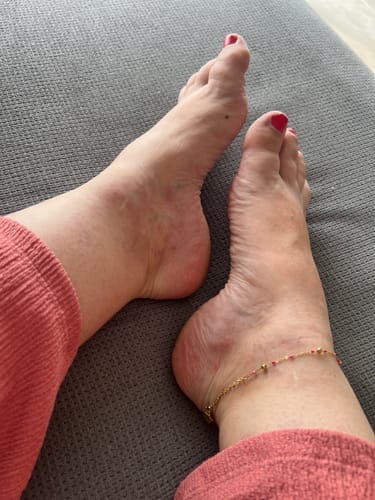 Customer photo review of Râpe Anti-Callosités Vantyx™ PRO