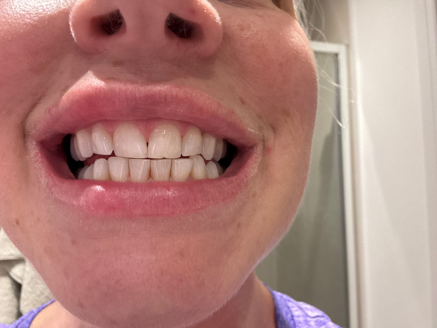 Customer photo review of Teeth Whitening Powder
