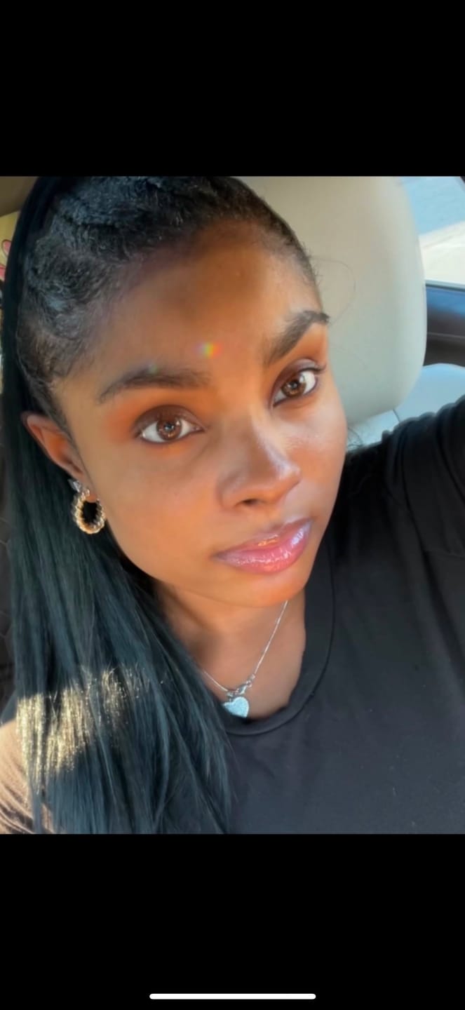 Customer photo review of Carotis Skin Brightening Cream 50g / 1.7 fl oz