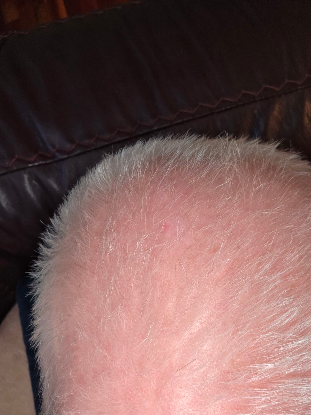 Customer photo review of Spartan™ Root Activator Shampoo 3 Bottles(sc)